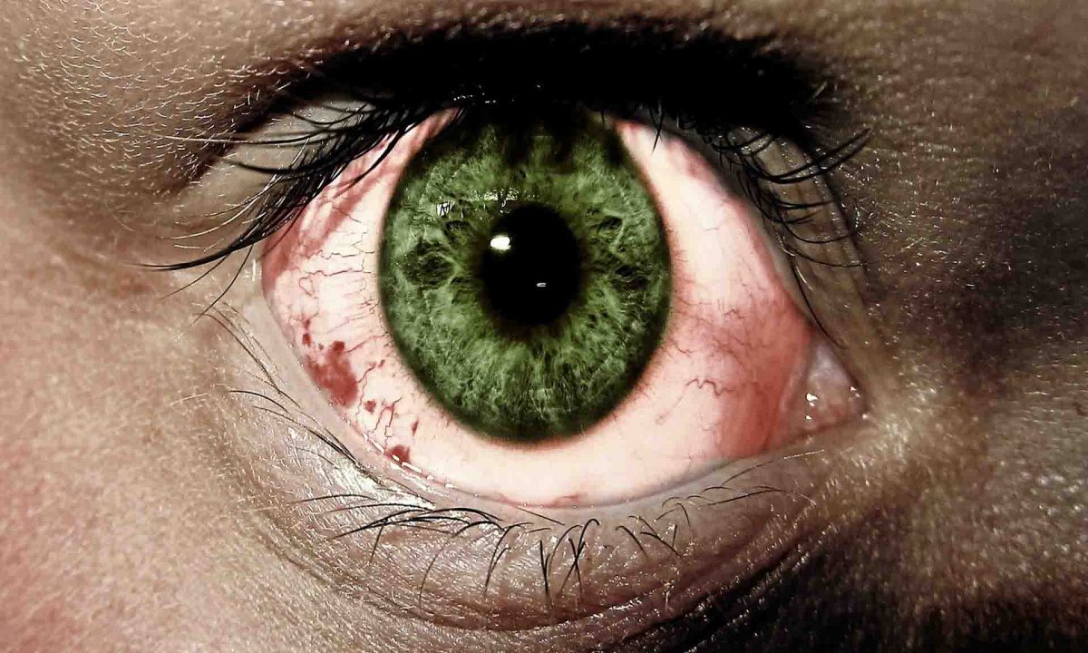 What are the symptoms for Red Eyes?